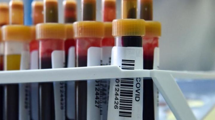 Azərbaycanda koronavirus ilə bağlı son vəziyyət açıqlandı