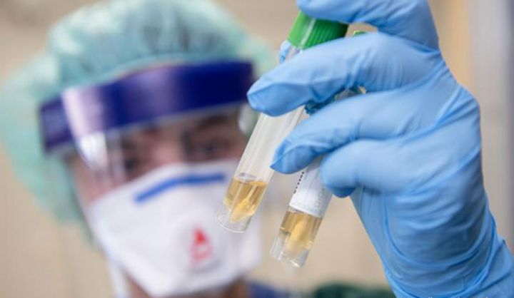 Azərbaycanda koronavirusa yoluxma faktı daha da artdı - SON VƏZİYYƏT