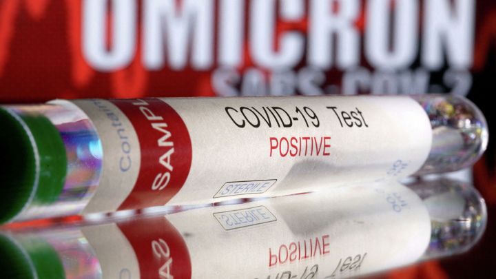 Özəl laboratoriyaların 2 test götürülməsi təklifilə bağlı RƏSMİ AÇIQLAMA