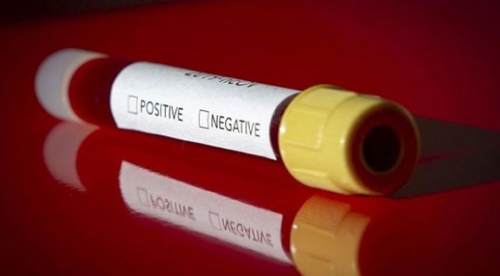 Nazir müavini koronavirusa yoluxdu