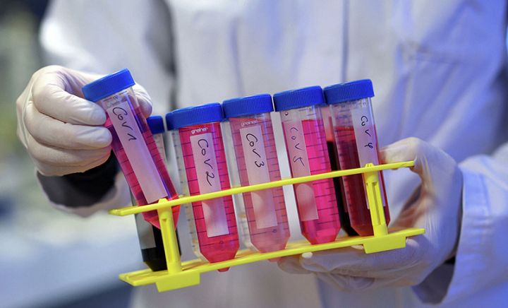 Azərbaycanda koronavirus ilə bağlı son vəziyyət açıqlandı